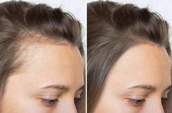 🔥 At-Home Precision Microneedling for Smoother Skin & Healthier-Looking Scalp
