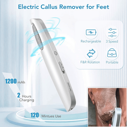upsell-🎁Portable Electric Feet Callus Remover-Hjmeta® (Copy)