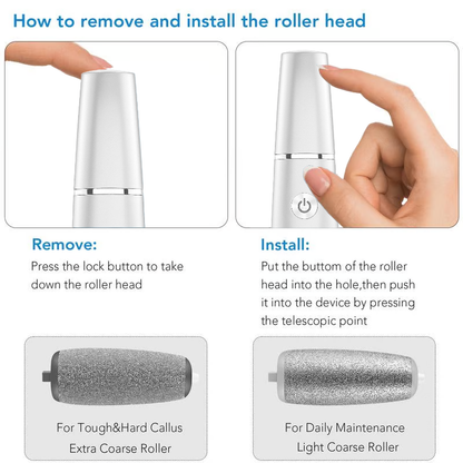 upsell-🎁Portable Electric Feet Callus Remover-Hjmeta® (Copy)