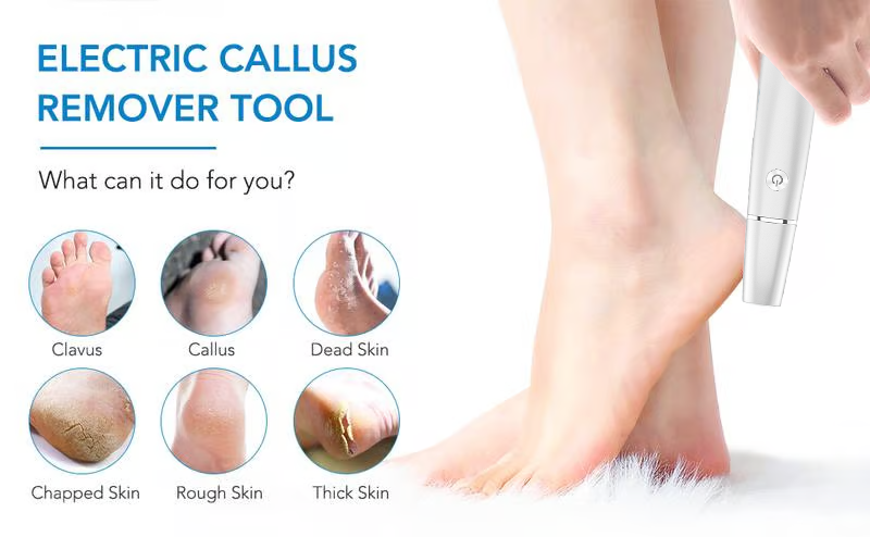 upsell-🎁Portable Electric Feet Callus Remover-Hjmeta® (Copy)