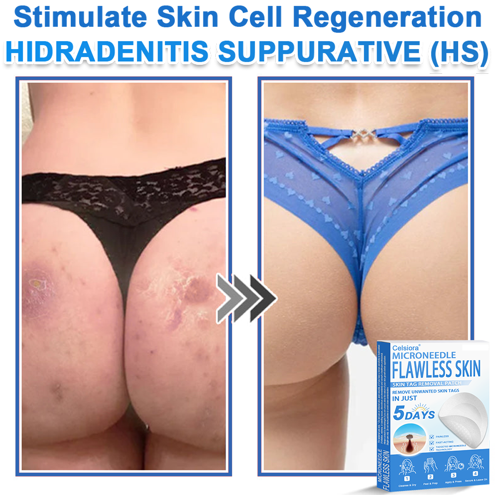 ✅ Celsiora® 2-in-1 Microneedle & Hydrocolloid Patch | Raised Moles,Acne,  Flat Warts & Skin Tags Remover | Improves Wrinkles, Scars & Blemishes | Invisible Pimple Patches for Face & Body