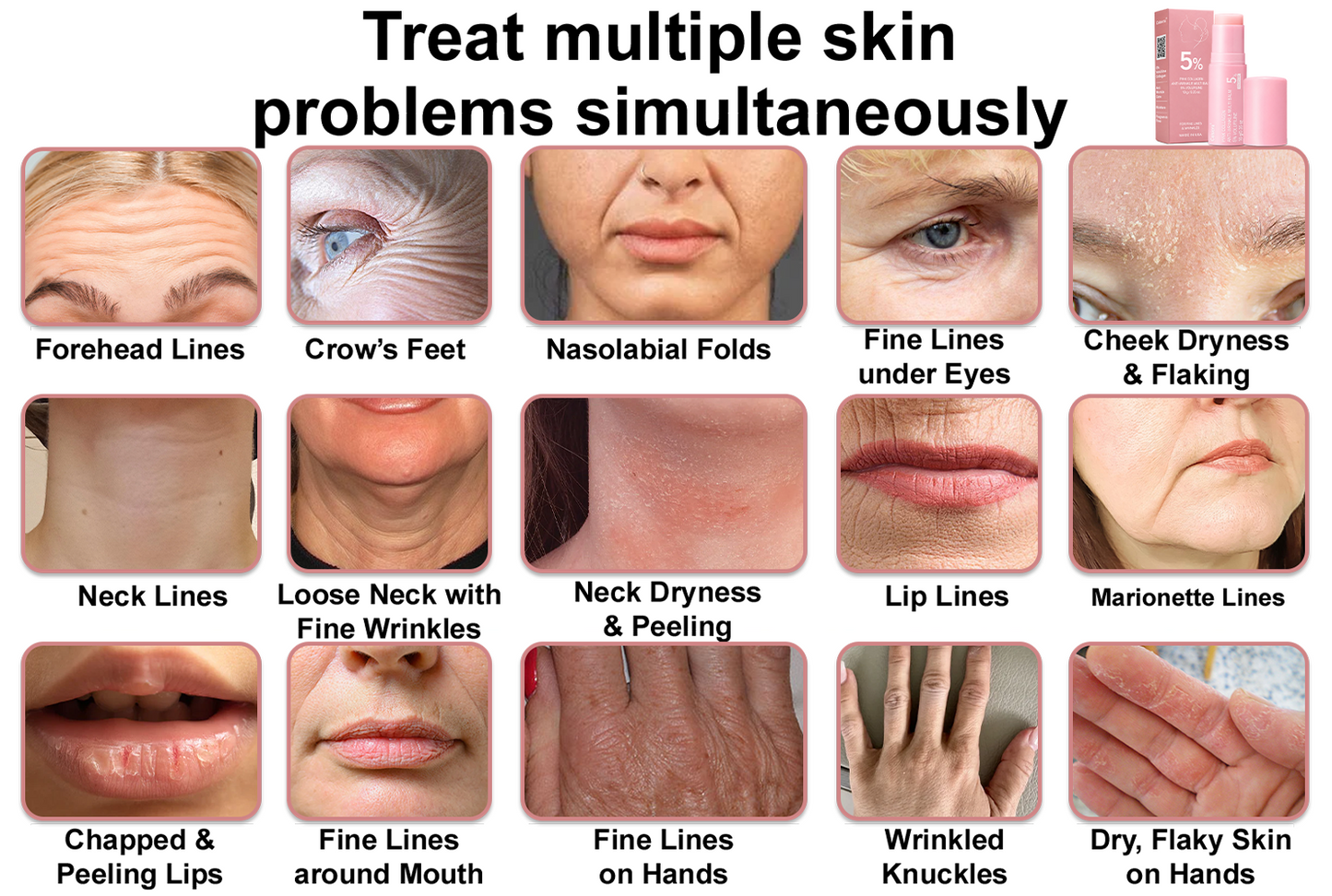 upsell-🥳60% OFF | Today Only!🥳💕PDRN Pink Collagen Volume Multi Balm | All In One Volufiline, PDRN, NAD Stick for Youthful-Looking
