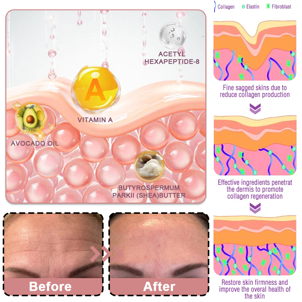 upsell-🥳60% OFF | Today Only!🥳💕PDRN Pink Collagen Volume Multi Balm | All In One Volufiline, PDRN, NAD Stick for Youthful-Looking