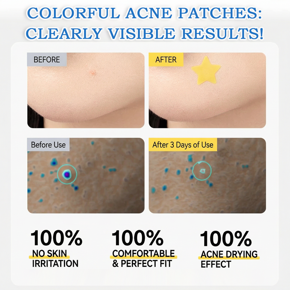 Devareon® 2-in-1 Microneedle & Hydrocolloid Star Patch 🌟 | Acne, Blackheads, Skin Tags & Raised Blemishes Remover 💫 | 6 Colors Pimple Patch for Face & Neck 🌸 | Invisible Star Zit Stickers ✨