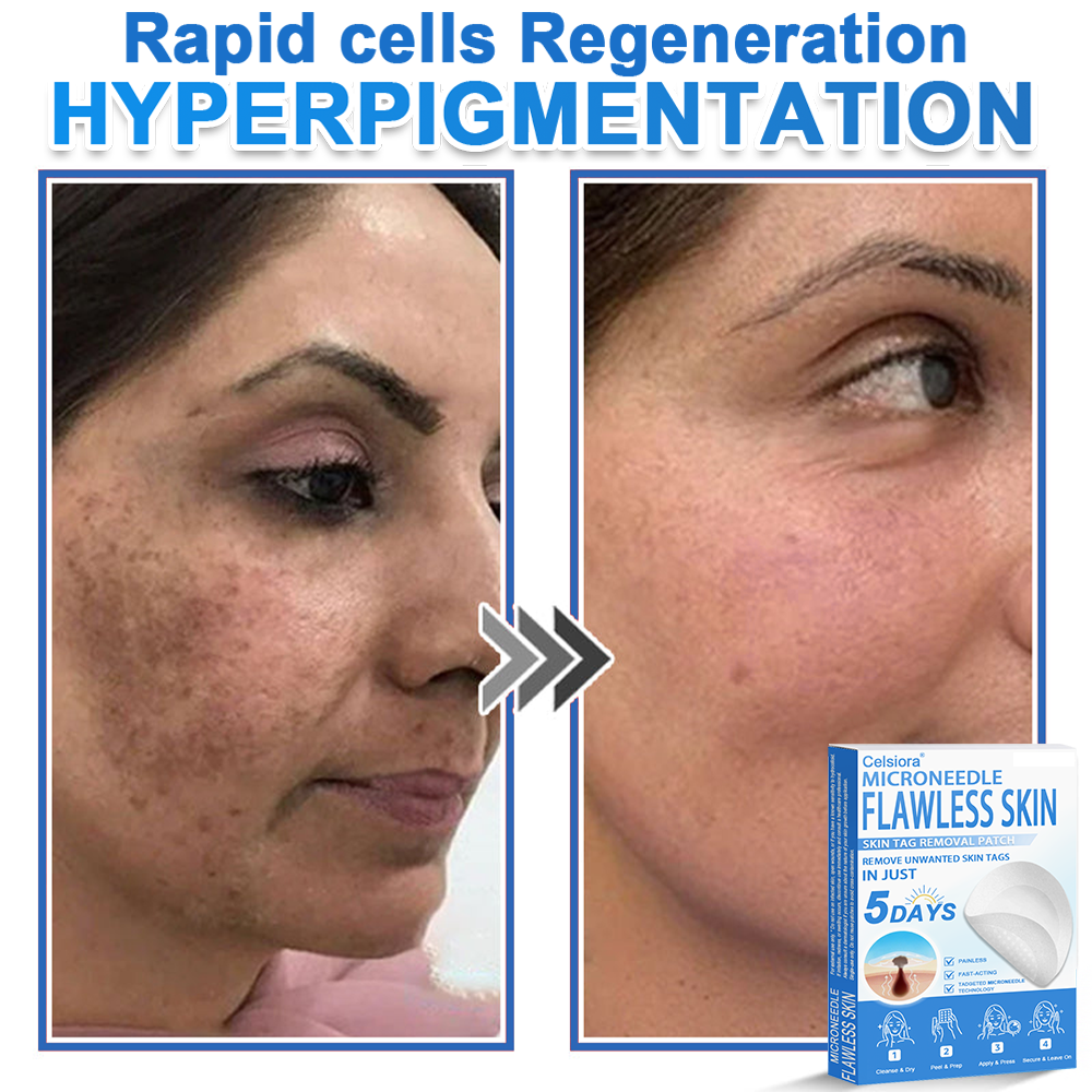 ✅ Celsiora® 2-in-1 Microneedle & Hydrocolloid Patch | Raised Moles,Acne,  Flat Warts & Skin Tags Remover | Improves Wrinkles, Scars & Blemishes | Invisible Pimple Patches for Face & Body