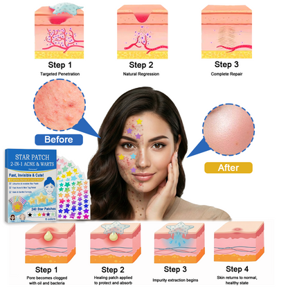 Devareon® 2-in-1 Microneedle & Hydrocolloid Star Patch 🌟 | Acne, Blackheads, Skin Tags & Raised Blemishes Remover 💫 | 6 Colors Pimple Patch for Face & Neck 🌸 | Invisible Star Zit Stickers ✨