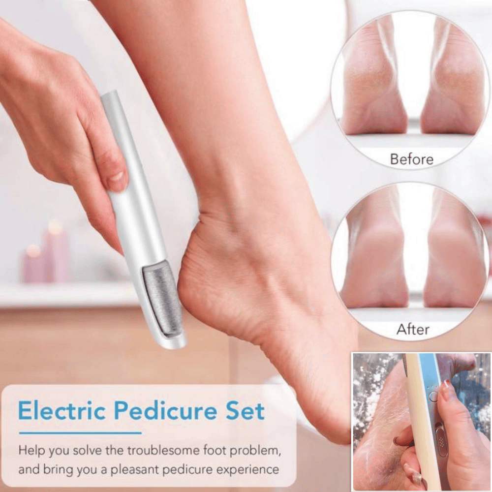 upsell-🎁Portable Electric Feet Callus Remover-Hjmeta® (Copy)