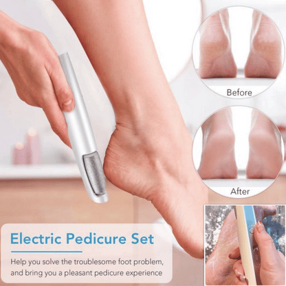 upsell-🎁Portable Electric Feet Callus Remover-Hjmeta® (Copy)